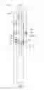 Fig. 03 - Electronically-activated liner hangers and methods of setting same in wellbore