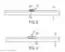 Fig. 06 - Subsurface fiber optic stimulation-flow meter