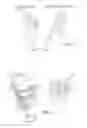 Fig. 03 - Rocker arm assembly and components therefor