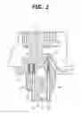 Fig. 03 - Bearing structure for multi-link-type piston crank mechanism for internal combustion engines