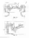 Fig. 06 - Engine Piston