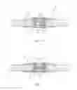 Fig. 03 - Coupling device