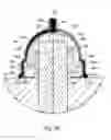 Fig. 03 - Injectable cap