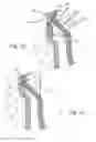 Fig. 10 - Injectable cap