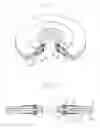 Fig. 19 - Gasket
