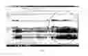 Fig. 05 - Method and device for detecting infrasound