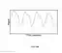 Fig. 201 - Systems and methods for noninvasive blood glucose and other analyte detection and measurement using collision computing