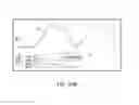 Fig. 205 - Systems and methods for noninvasive blood glucose and other analyte detection and measurement using collision computing