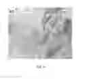 Fig. 08 - Strain mapping in TEM using precession electron diffraction