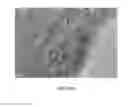 Fig. 21 - Strain mapping in TEM using precession electron diffraction