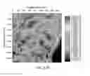 Fig. 26 - Strain mapping in TEM using precession electron diffraction