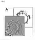 Fig. 02 - Method of detecting the presence or absence of autoantibodies