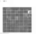 Fig. 04 - Method of detecting the presence or absence of autoantibodies