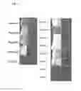 Fig. 07 - Method of detecting the presence or absence of autoantibodies