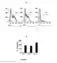 Fig. 07 - Shear Wave Imaging Method and Installation for Collecting Information on a Soft Solid