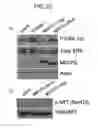Fig. 24 - Oncogene associated with human cancers and methods of use thereof