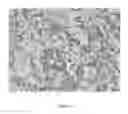 Fig. 03 - Methods and materials for treating renal cell carcinoma