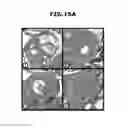 Fig. 24 - Method and apparatus for multi-slice imaging of T2-relaxation time