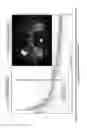 Fig. 17 - Apparatuses, methods and systems for estimating water diffusivity and microcirculation of blood using DW-MRI data