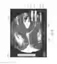 Fig. 26 - Upright and inverted microscope