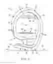 Fig. 03 - Visual and tactile assessment tool