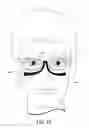 Fig. 12 - Eyeblack glass frames