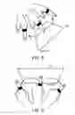 Fig. 04 - Recognition device, method, and storage medium