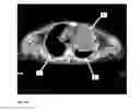 Fig. 19 - Method and system for automated quality assurance and automated treatment planning in radiation therapy