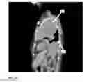 Fig. 20 - Method and system for automated quality assurance and automated treatment planning in radiation therapy