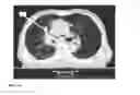 Fig. 22 - Method and system for automated quality assurance and automated treatment planning in radiation therapy