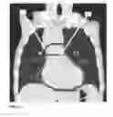 Fig. 24 - Method and system for automated quality assurance and automated treatment planning in radiation therapy