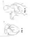Fig. 05 - Method and system for image processing to determine patient-specific blood flow characteristics