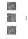 Fig. 06 - System and method for enhanced defect detection with a digital matched filter