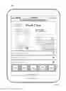 Fig. 08 - Deal-surfacing button