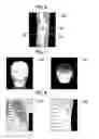 Fig. 05 - Radiation-image processing device and method