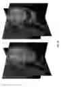 Fig. 15 - Ultrasound-based volumetric particle tracking method