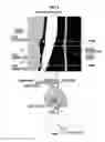 Fig. 04 - Medical image display control device, method of operation for same, and medical image display control program