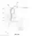 Fig. 03 - Wearable posture regulation system and method to regulate posture