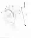 Fig. 04 - Wearable posture regulation system and method to regulate posture