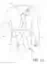 Fig. 12 - Tactile Input for Improving Physical Movement