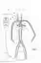 Fig. 03 - Post mortem reconstitution of circulation