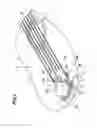 Fig. 02 - Device for vibrating a stringed instrument