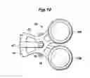 Fig. 11 - Device for vibrating a stringed instrument