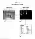 Fig. 04 - Speech recognition candidate selection based on non-acoustic input