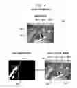 Fig. 05 - Speech recognition candidate selection based on non-acoustic input