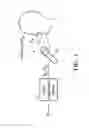 Fig. 02 - Noise cancellation method