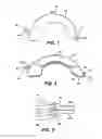 Fig. 05 - Nesting disk separator plates for use in hard disk drives
