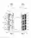 Fig. 03 - On-load tap changer, method for installing a load transfer switch insert in the on-load tap changer, and kerosene drain screw