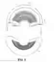 Fig. 04 - Strain relief device for a harness or cable