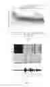 Fig. 06 - METHOD FOR COMPENSATING FOR HEARING LOSS IN A TELEPHONE SYSTEM AND IN A MOBILE TELEPHONE APPARATUS